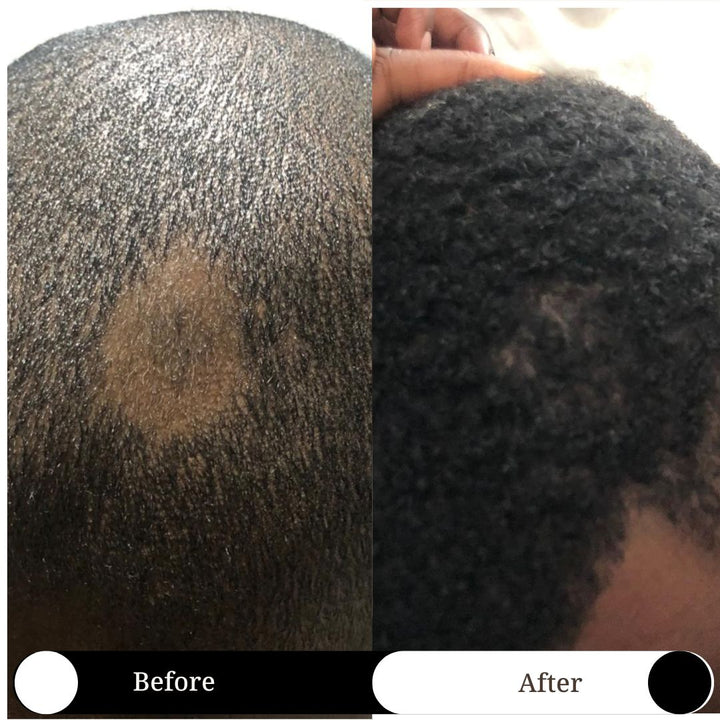 SET OF 4 - Hair Loss Recovery for Men Travel Size